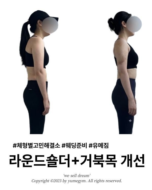 웨딩준비 라운드숄더+거북목 개선