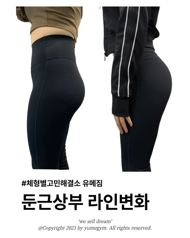 둔근상부 라인변화