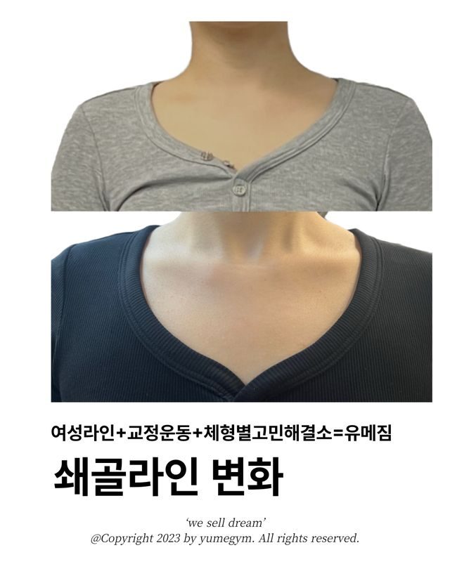쇄골라인 변화