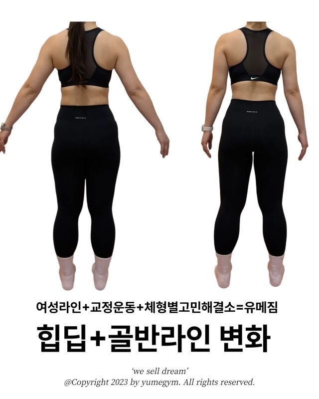 힙딥+골반라인 변화